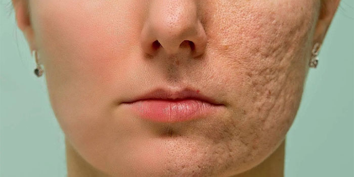 Blog - Skin Difference Between Men and Women