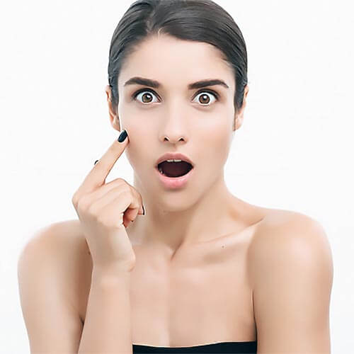 Acne and Acne Scar Treatment - Best Laser Treatments in Dubai