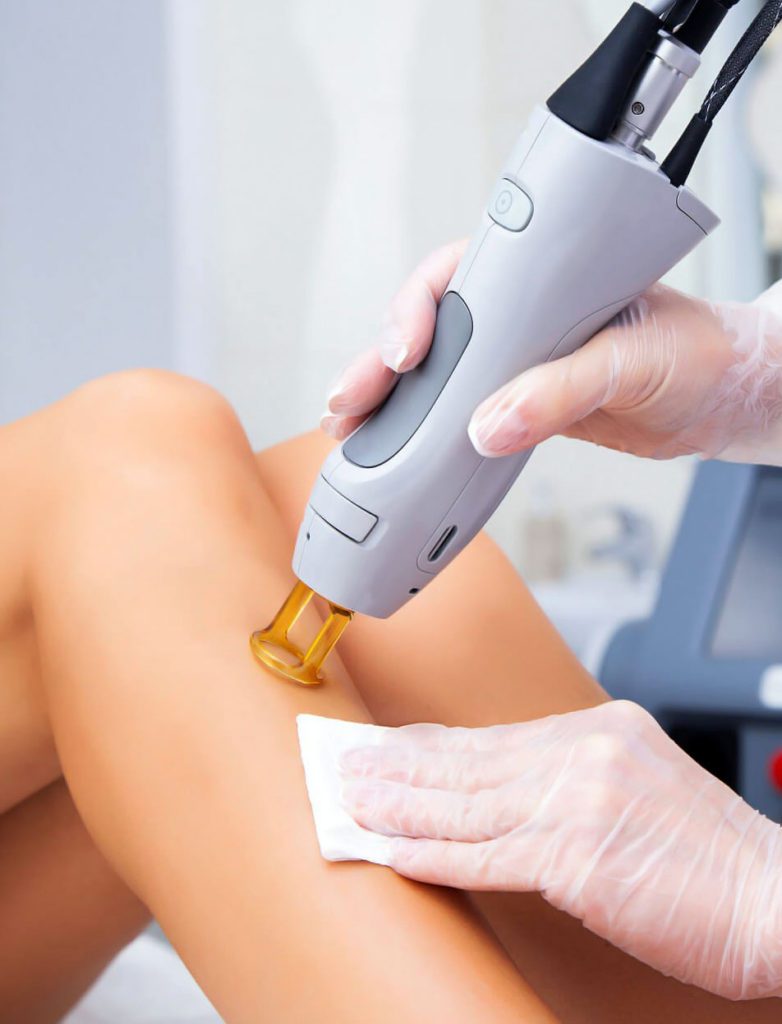 Laser Hair Removal Myths and Facts
