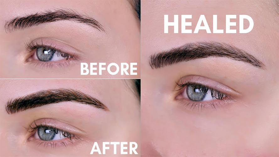 MicroBlading-before-after-Dubai