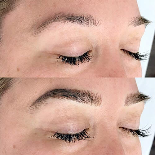 Microblading-dubai-before-after-esteem-medical-clinic