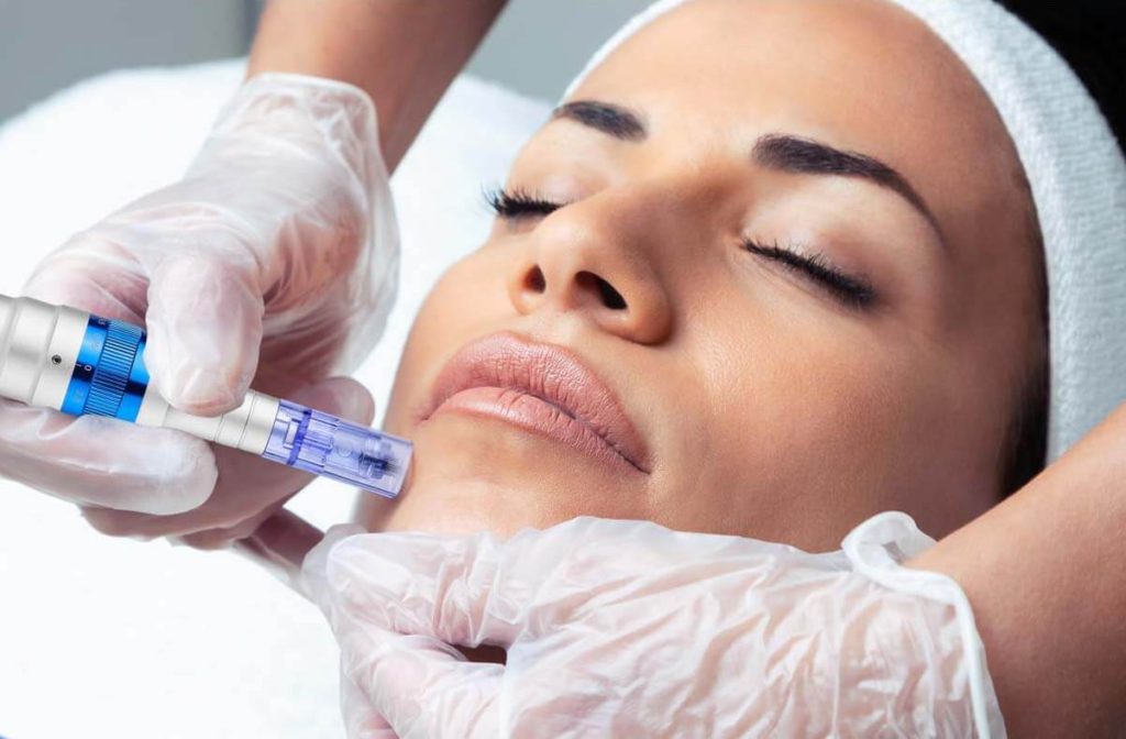 Microneedling in Dubai_Dermapen Microneedling_Esteem Medical Clinic