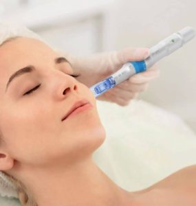 Microneedling in Dubai_Dermapen Microneedling_Esteem Medical Clinic